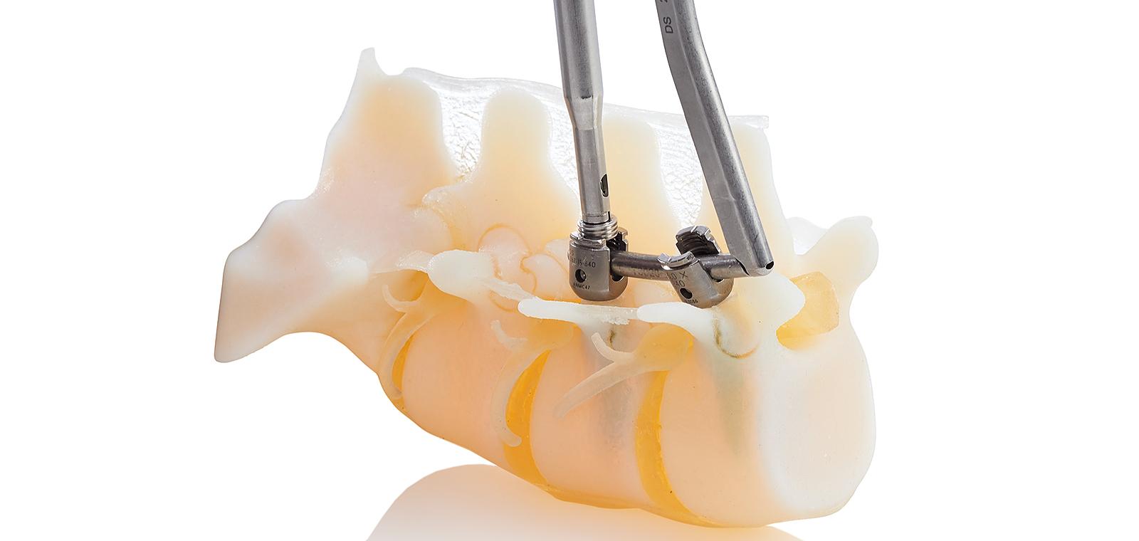 Innovation en Santé : L'impact de l'impression 3D sur la fabrication des dispositifs médicaux