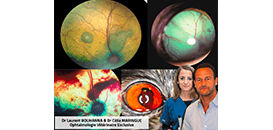Cas cliniques interactifs sur les lésions oculaires liées à l'hypertension artérielle féline